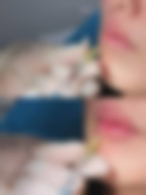 昆山市第一人民医院烧伤整形外科真实患者口碑评价