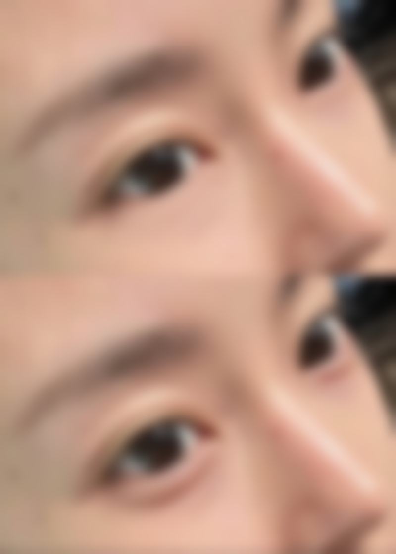 莱芜市人民医院整形美容科价格表