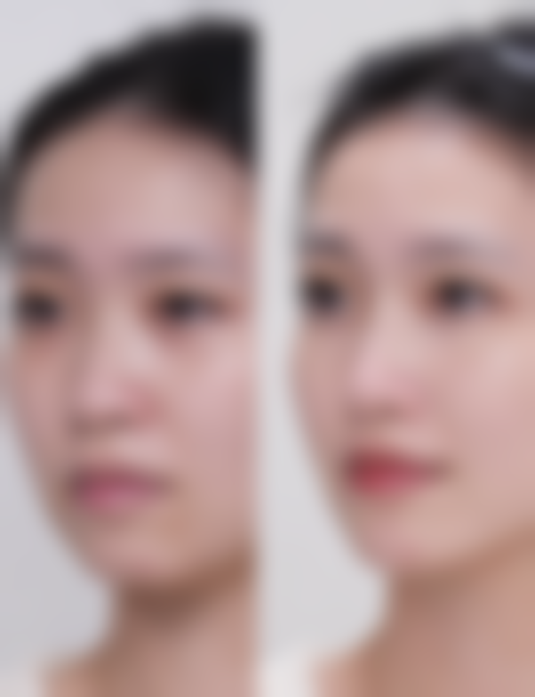 手术伤口疤痕增生用什么方法治疗