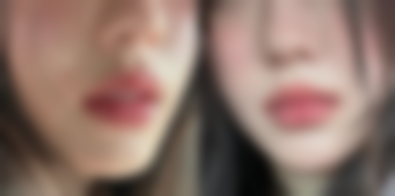 武汉微整形正规医院十大排名之武汉五洲莱美整形医院