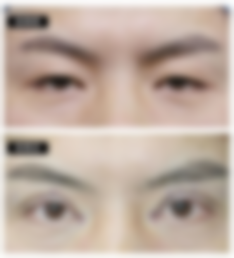 河北医 科 大学第三医院张川医生谈激光治疗：高新科技的“疤痕橡皮擦”