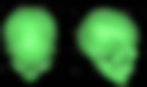 国内医学科学 院整形外科医院推荐眼部淋巴引流按摩消黑眼圈黑眼袋