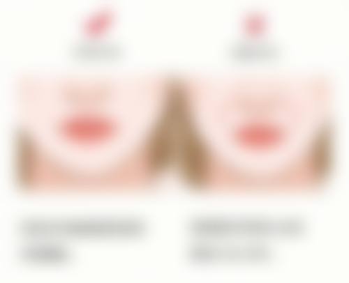 不同黑眼圈类型解决方案对比