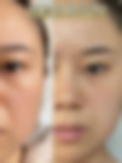 东莞虎门格美雅韵医疗美容门诊部顾客实例