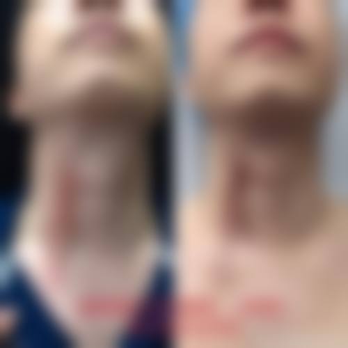 汕头大学医学校第一附属医院口碑好不好？附真实患者口碑评价