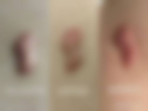 乌兰察布联城东美医疗美容诊所价格表