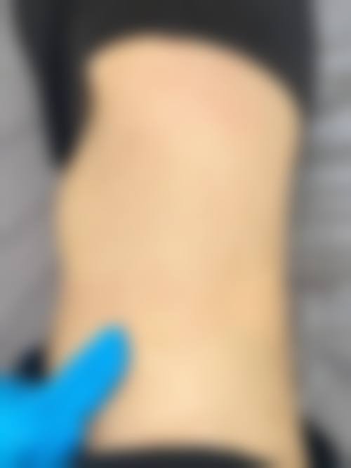 梅爱任医生简介口碑如何