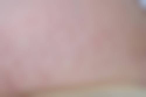 深圳明伦整形美容医院口碑评价如何