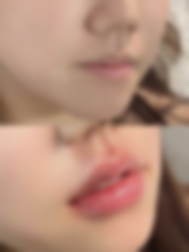 中医怎么治疗疤痕疙瘩之中药外敷：直接作用于疤痕局部