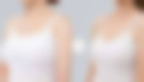 韩国美来整形医院口碑好不好？附真实患者口碑评价