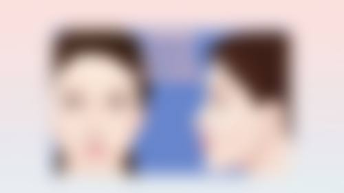 埋线双眼皮消失的渐进过程——从轻微松弛到完全消失的职场比喻