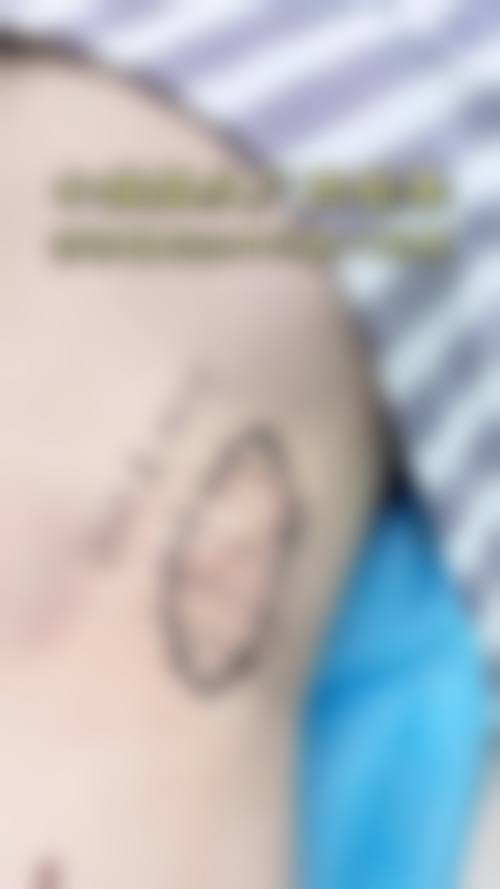 兰州手足外科医院价格表