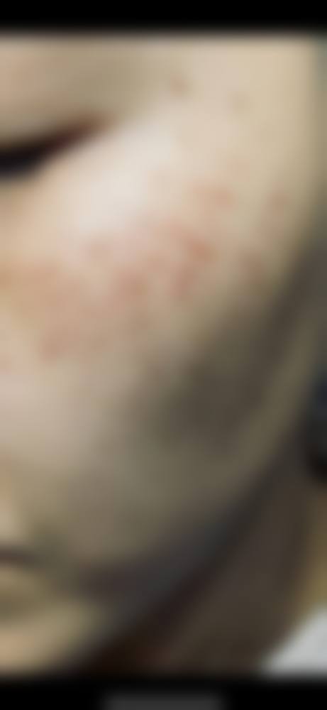 韩国美来整形医院项目特色