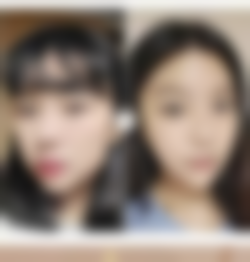 消失后能否二次埋线——国内医学科学 院讲解修复手术注意事项