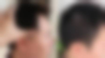 芜湖东方美莱坞医疗美容门诊部价格表