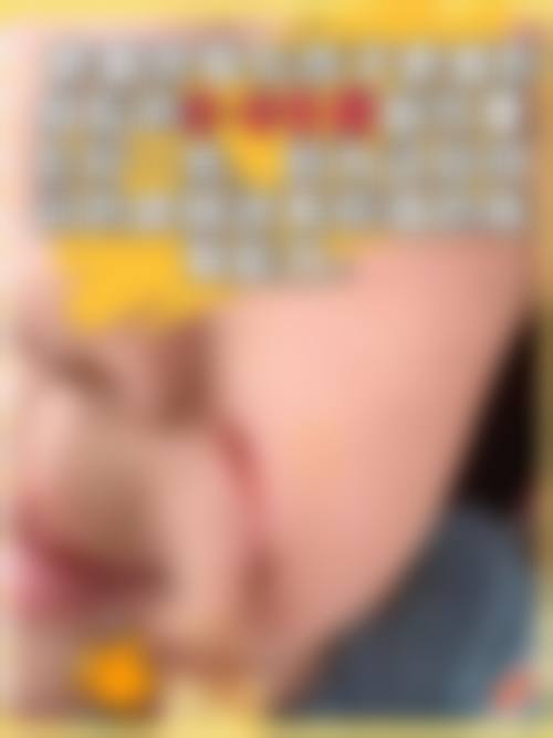 芜湖东方美莱坞医疗美容门诊部顾客实例