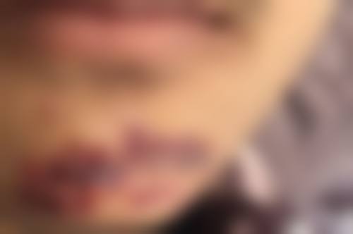 上海宸山皮肤科诊所评价