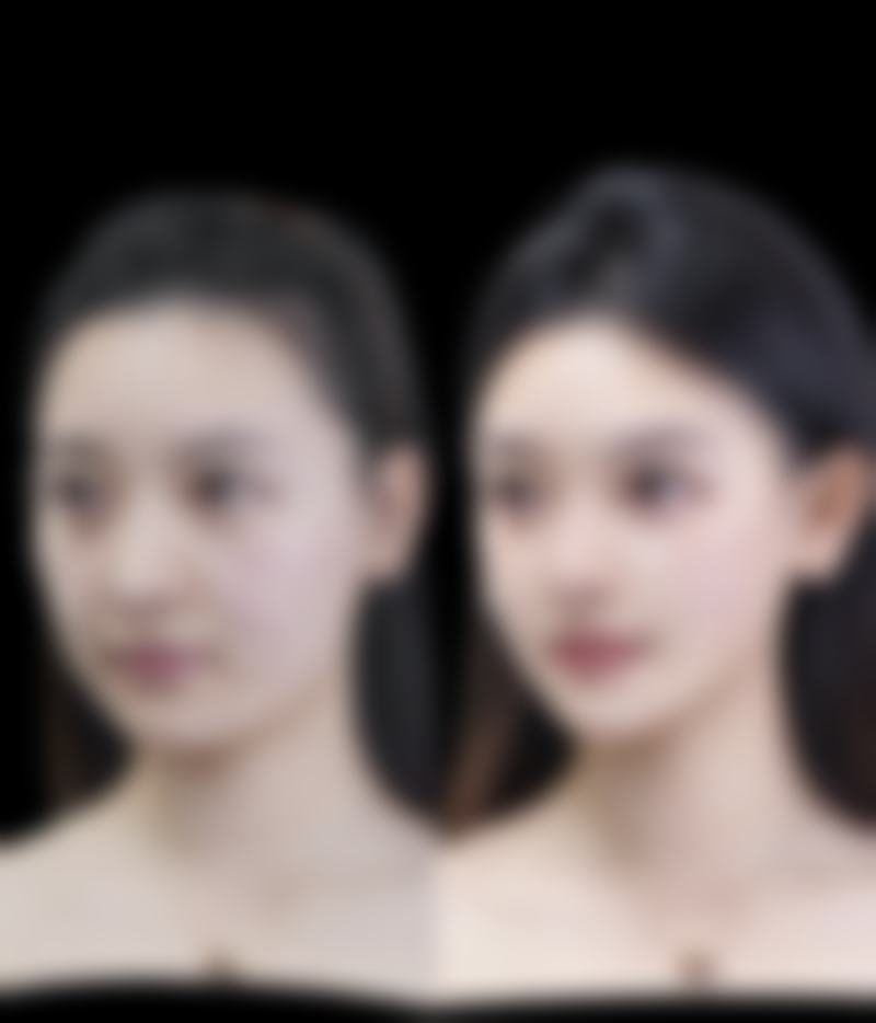 脸上有疤痕有什么办法可以修复——小荷医典骨干医生团物理疗法：冷热交替的奇妙成效