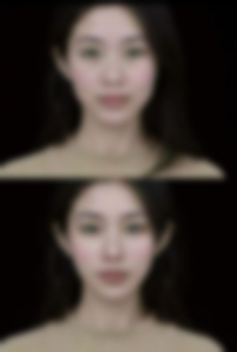 广州睿斯整形门诊部价格表