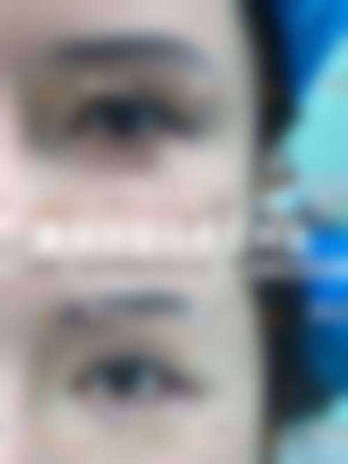 武汉爱思特整形医院口碑好不好