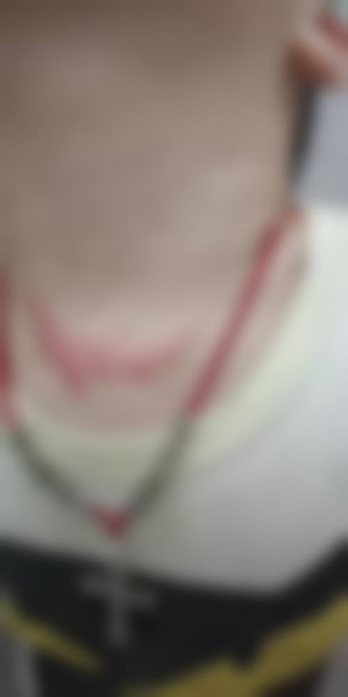 广州仁爱整形医院口碑好不好？附真实患者口碑评价