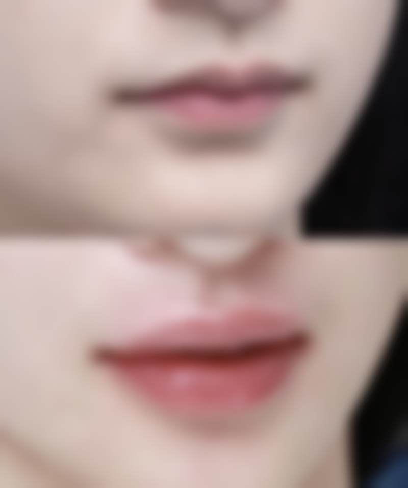 广州仁爱整形医院价格表