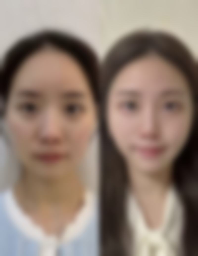 王广胜医生简介做手术价格