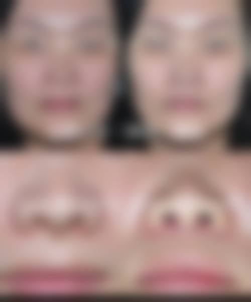 深圳美客华美整形美容医院真实患者口碑评价