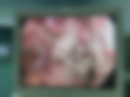 肖旭远医生简介之项目优势