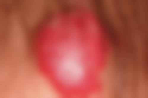 扬州开发韩美医疗美容诊所价格表