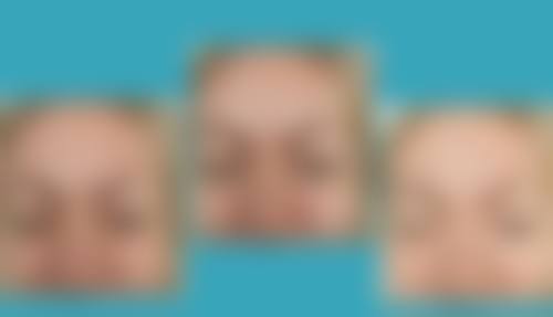 深圳美客华美整形美容医院口碑评价