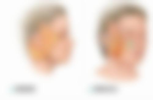 张志诚医生怎么挂号