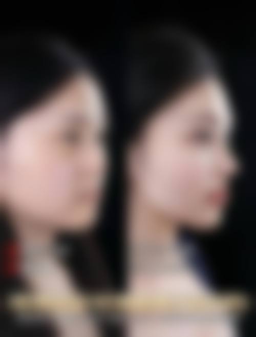 李越钢医生简介项目优势