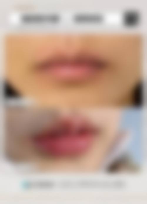 李越钢医生简介口碑如何