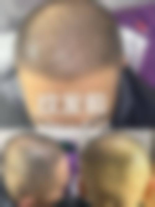 深圳赫思名品整形医院价格表