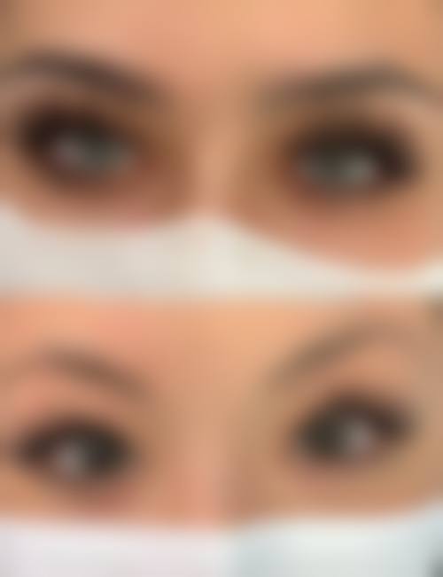 韩国Joseph整形外科口碑情况