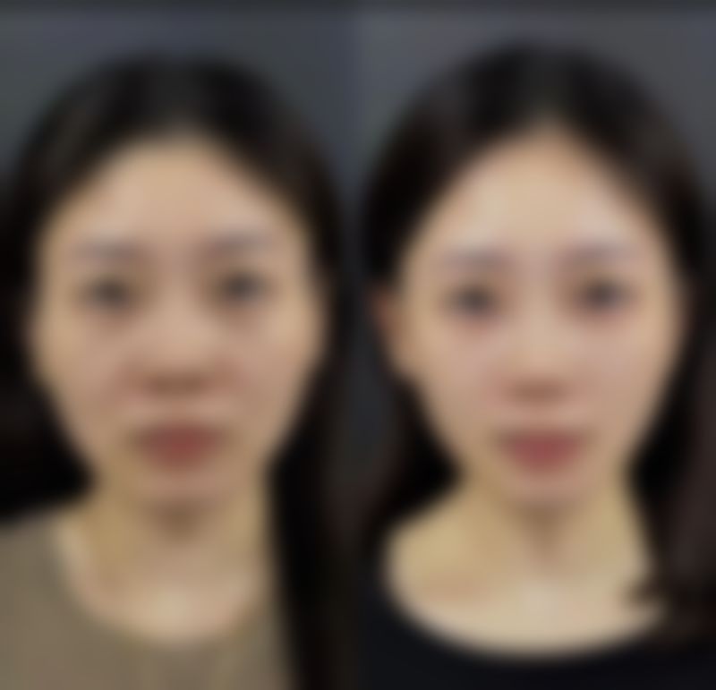 钟国良医生简介口碑如何