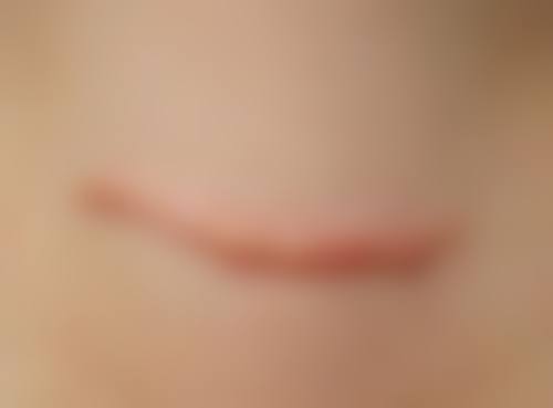 万州华美紫馨整形美容医院口碑评价