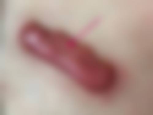 昆明菲岫皮肤医疗美容诊所怎么样，怎么挂号，地址在哪儿