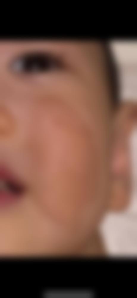 万州华美紫馨整形美容医院口碑好不好