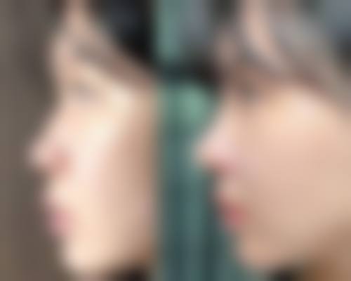 张陈威医生简介口碑如何