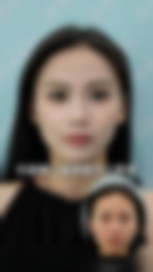 万州华美紫馨整形美容医院价格表