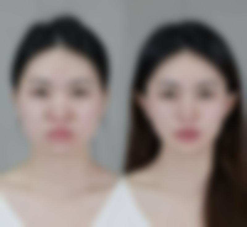 烟台宝菲整形医院价格表