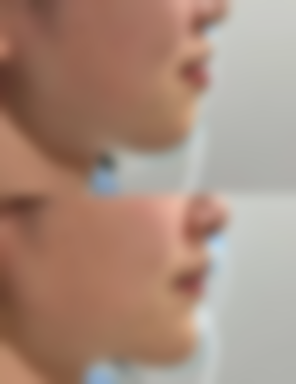 宜兴臻悦整形医院口碑好不好？附真实患者口碑评价