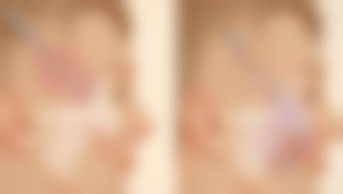 王医生医生做手术价格