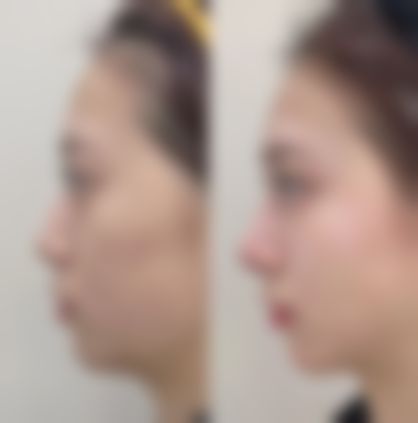 文山康颜医疗美容诊所评价