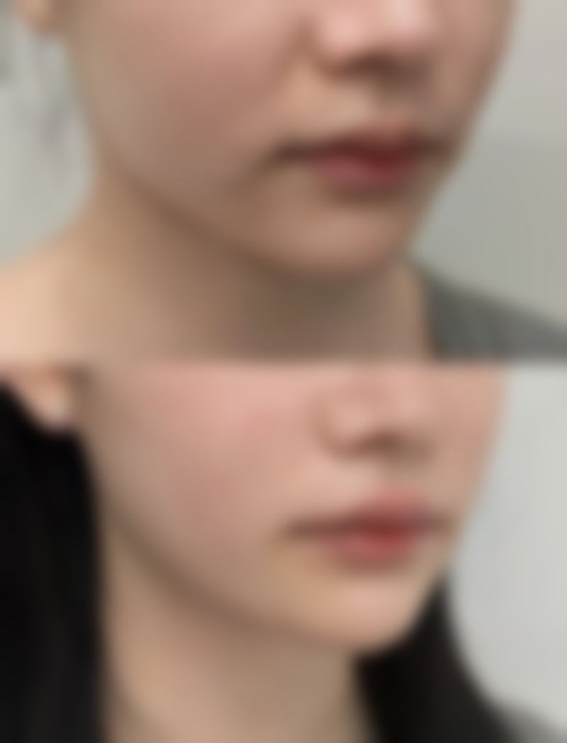 李相喆医生项目优势