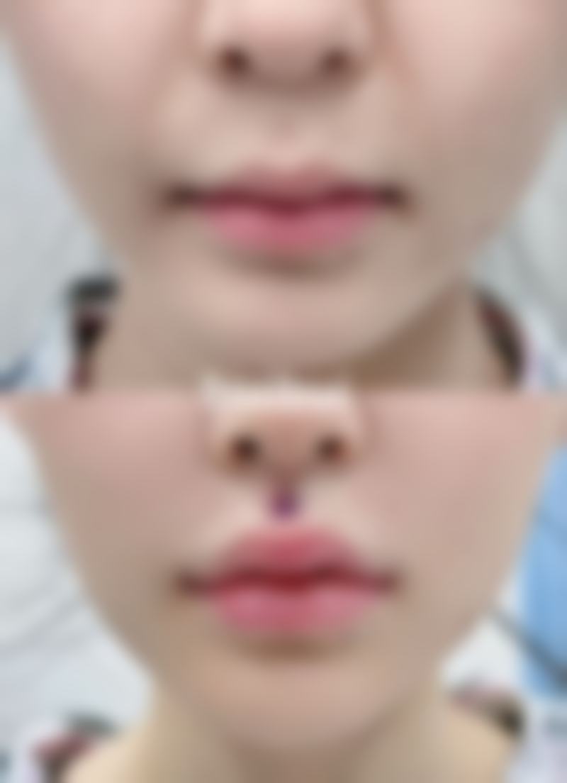 Renaissance美容外科南堀江正规吗