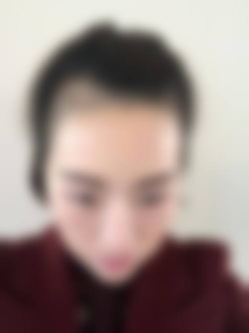 济南星光医疗美容抖音团购活动及价格表