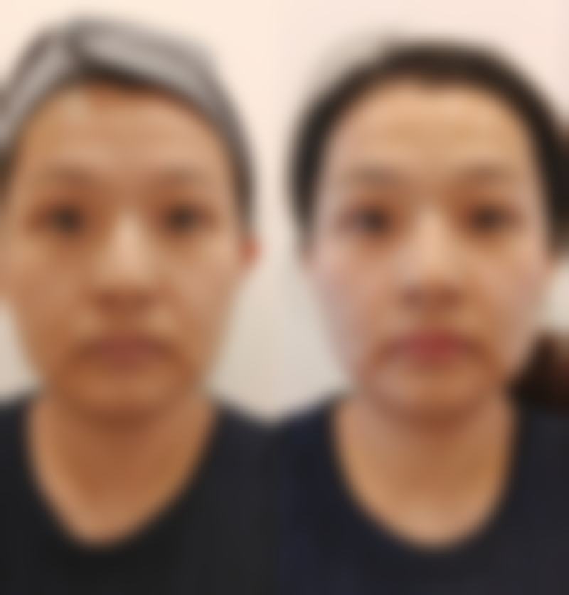 哈尔滨钟医生整形门诊上班时间和地址